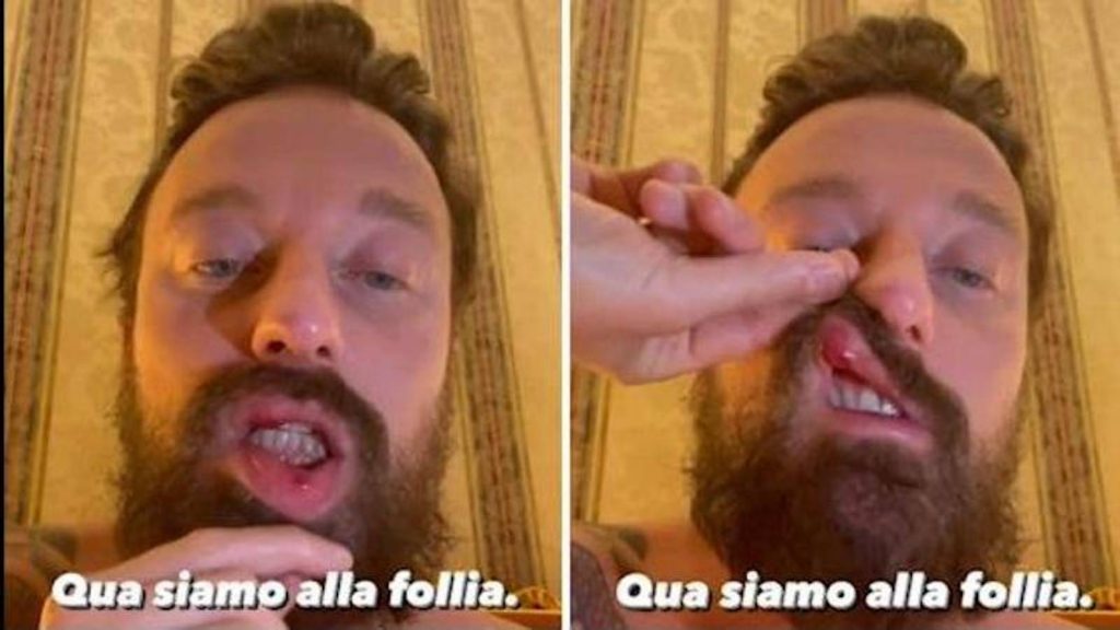 Facchinetti McGregor